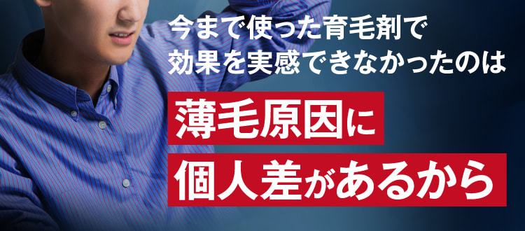 今まで使った育毛剤で効果を実感できなかったのは薄毛原因に個人差があるから