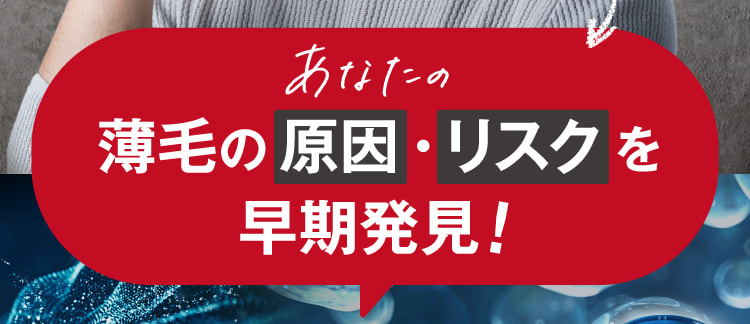 あなたの薄毛の原因・リスクを早期発見!