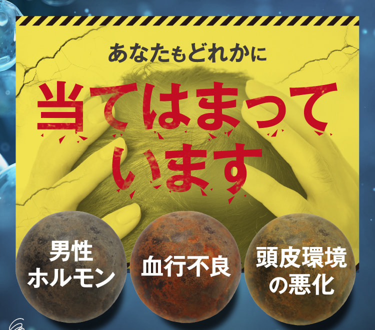 あなたもどれかに当てはまっています 男性ホルモン 血行不良 頭皮環境の悪化