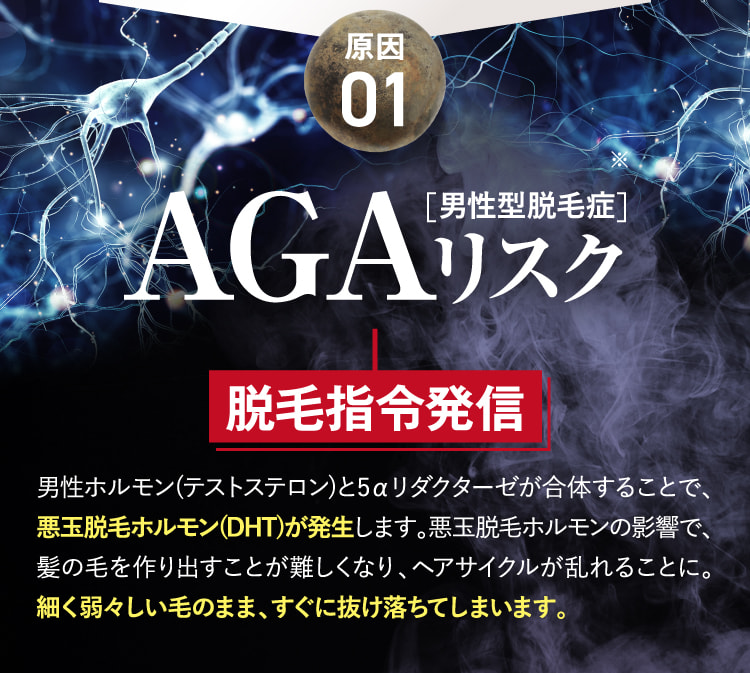 原因01 AGAリスク 脱毛指令発信