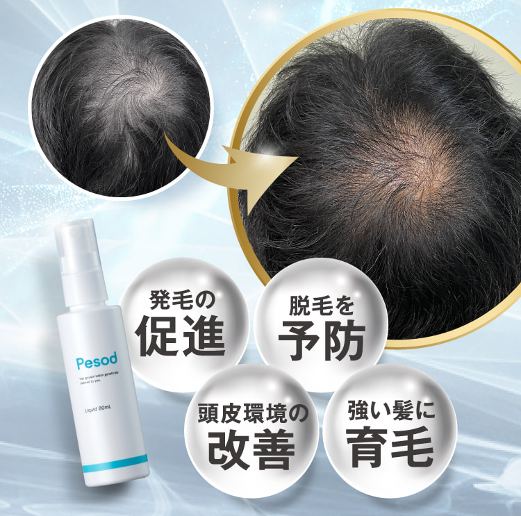 発毛の促進 脱毛を予防 頭皮環境の改善 強い髪に育毛