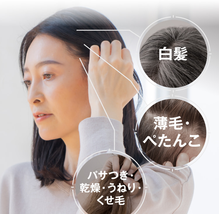 頭頂部 生え際 全体
