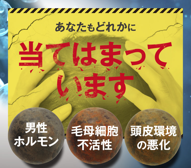 あなたもどれかに当てはまっています 男性ホルモン 血行不良 頭皮環境の悪化