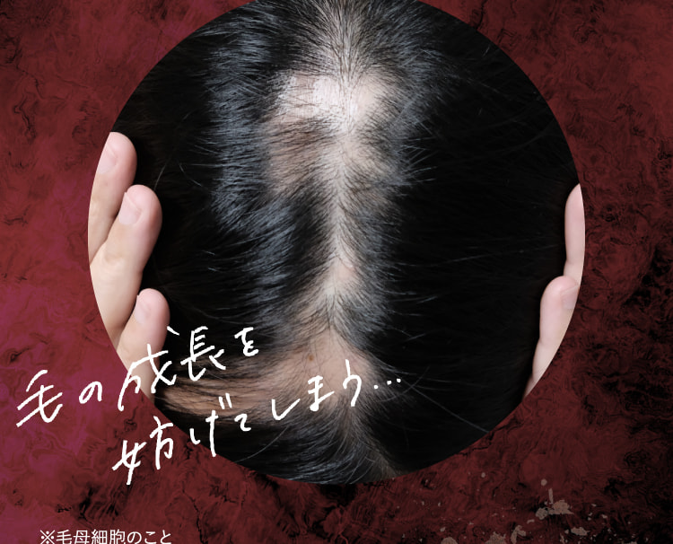 毛の成長を妨げてしまう…