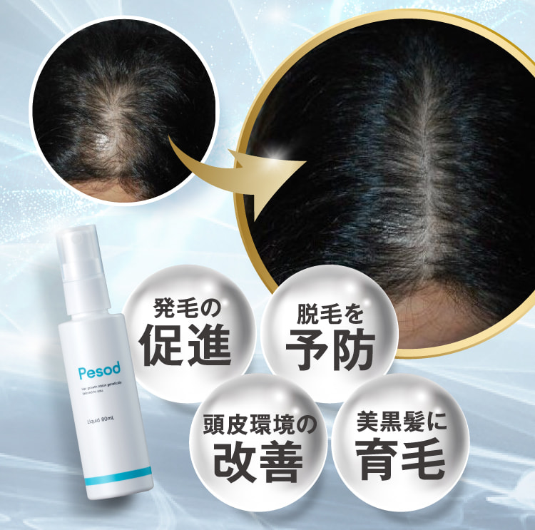 発毛の促進 脱毛を予防 頭皮環境の改善 強い髪に育毛